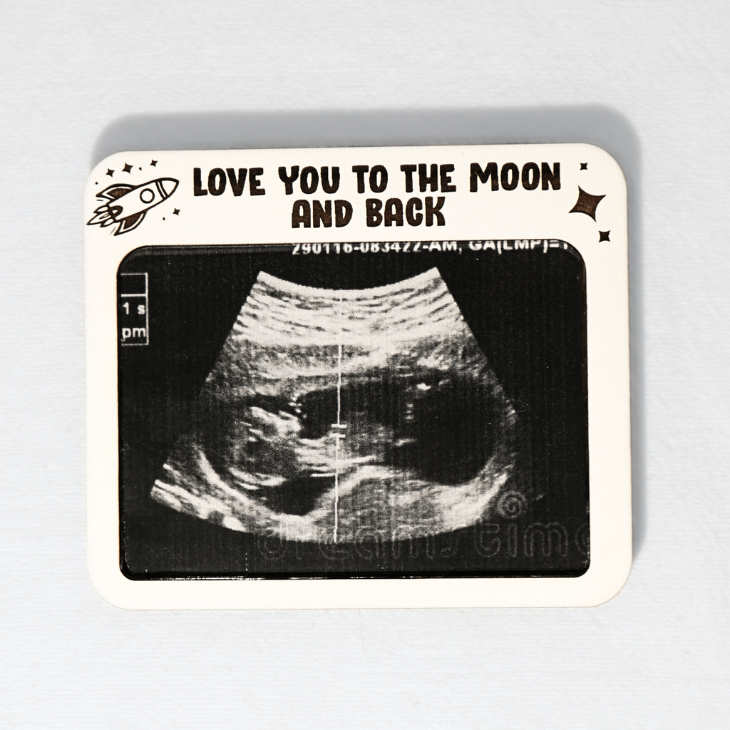 Ultrasound Frame Magnet Moon