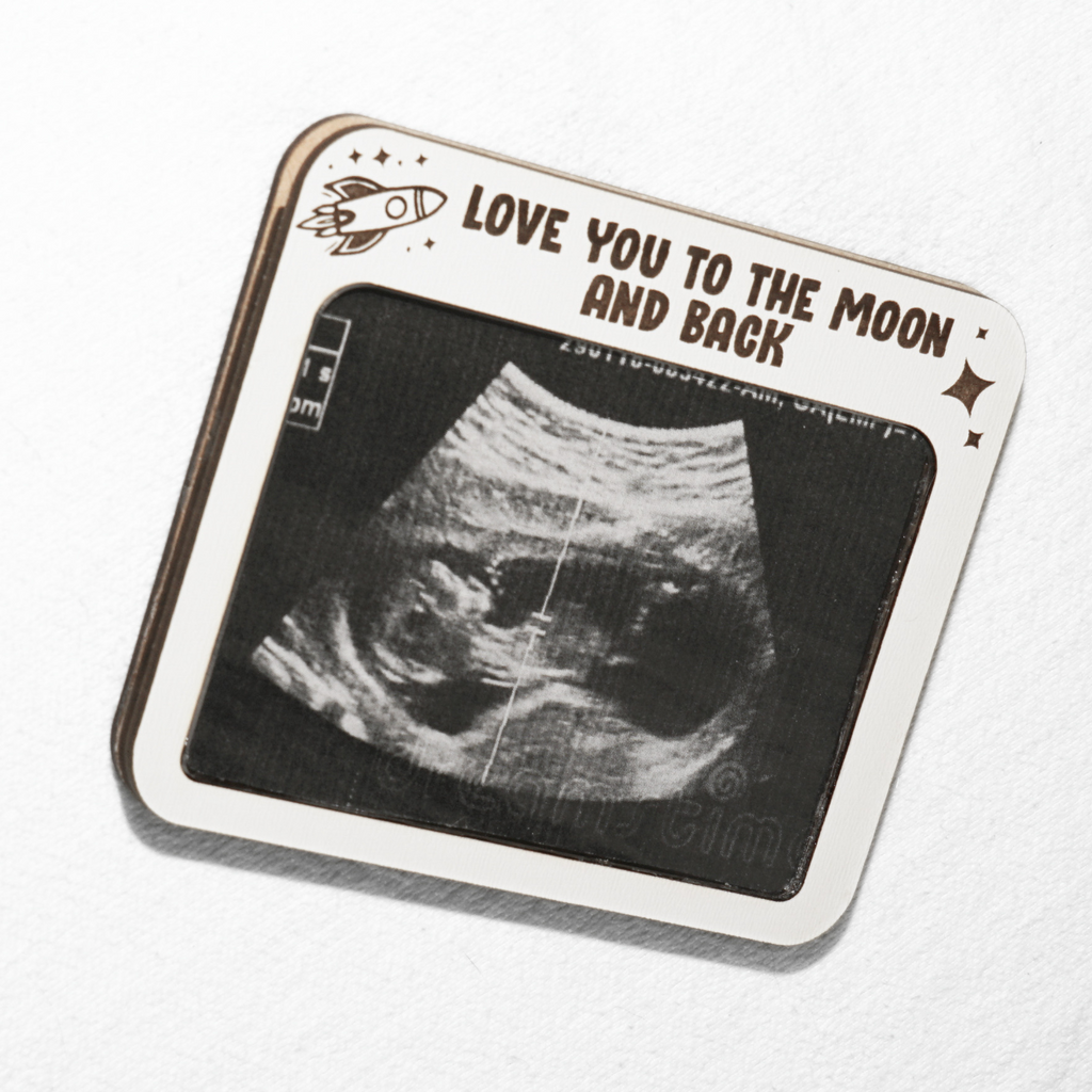 Ultrasound Frame Magnet Moon