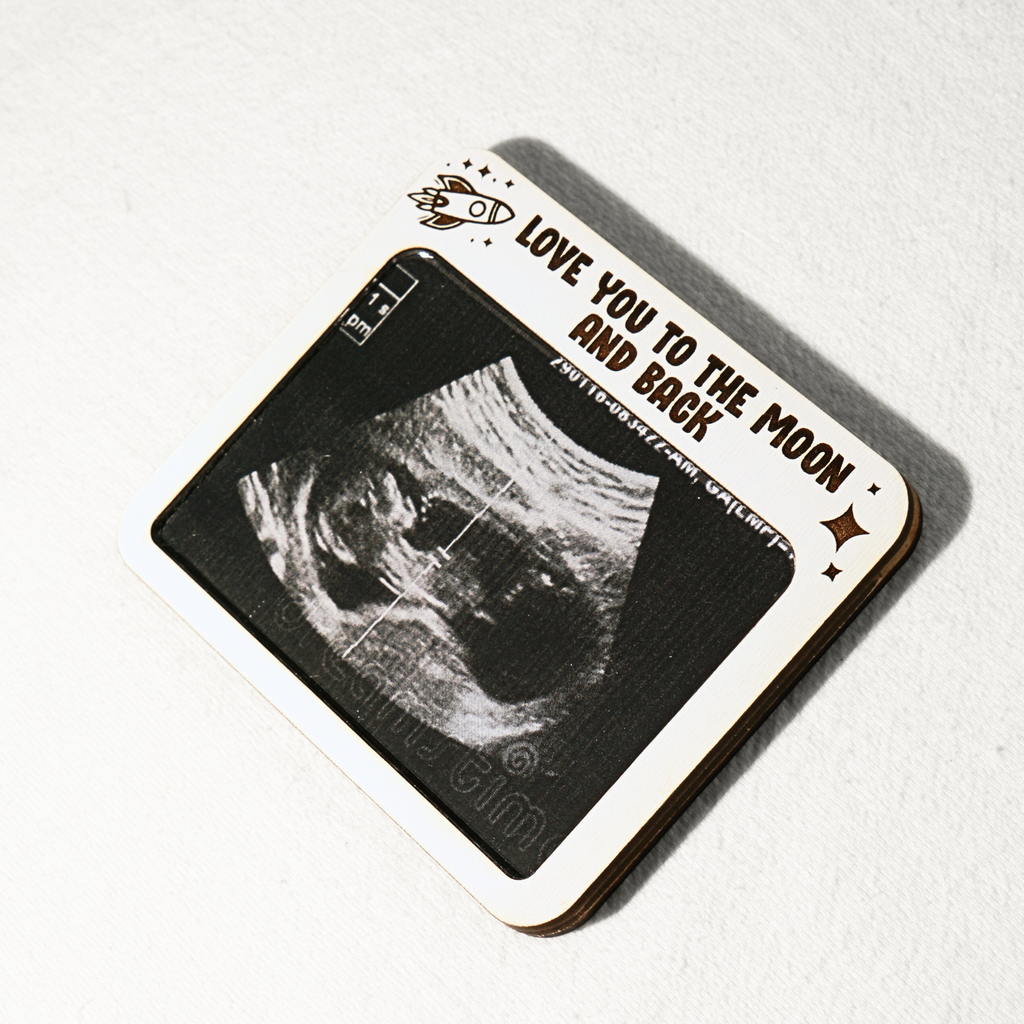 Ultrasound Frame Magnet Moon
