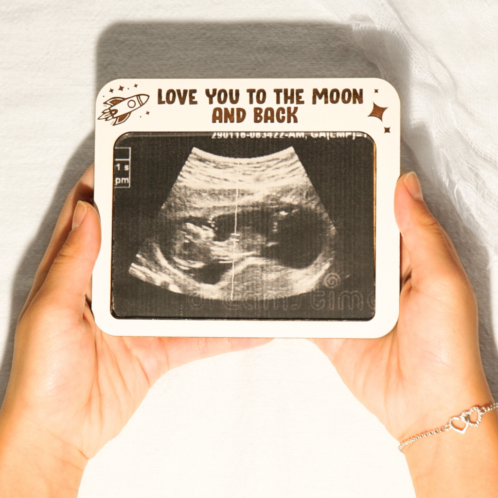 Ultrasound Frame Magnet Moon